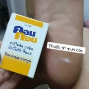 Thuốc chấm đặc trị mụn cóc CON CON Thái Lan