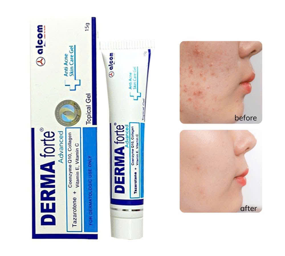 Gel mụn Derma forte Advanced 15g